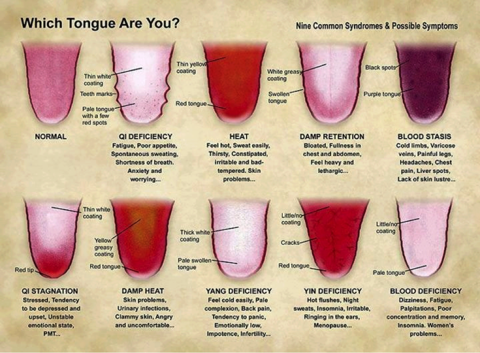 Chinese medicine tongue chart